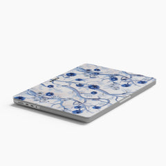 BLUE MONSOON Macbook Case