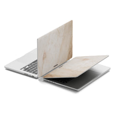 LIMELIGHT Macbook Case