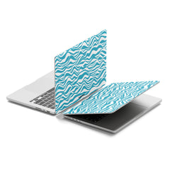 BEACH PLEASE Macbook Case