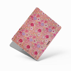 PINCASA Macbook Case