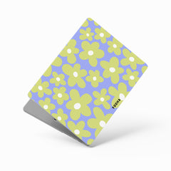 SPRINGTIME Macbook Case