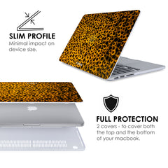 SUNFLOWER Macbook Case