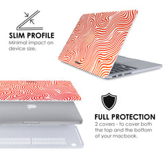 MIA Macbook Case